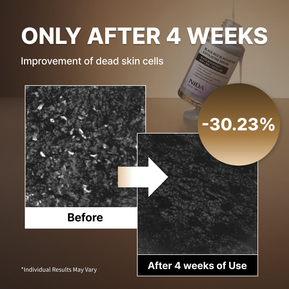 SkinShield Black Rice Blackhead Exfoliating Serum