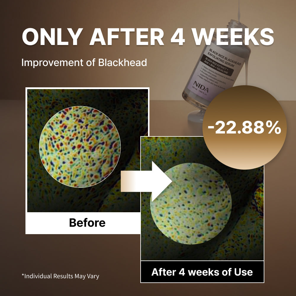 SkinShield Black Rice Blackhead Exfoliating Serum