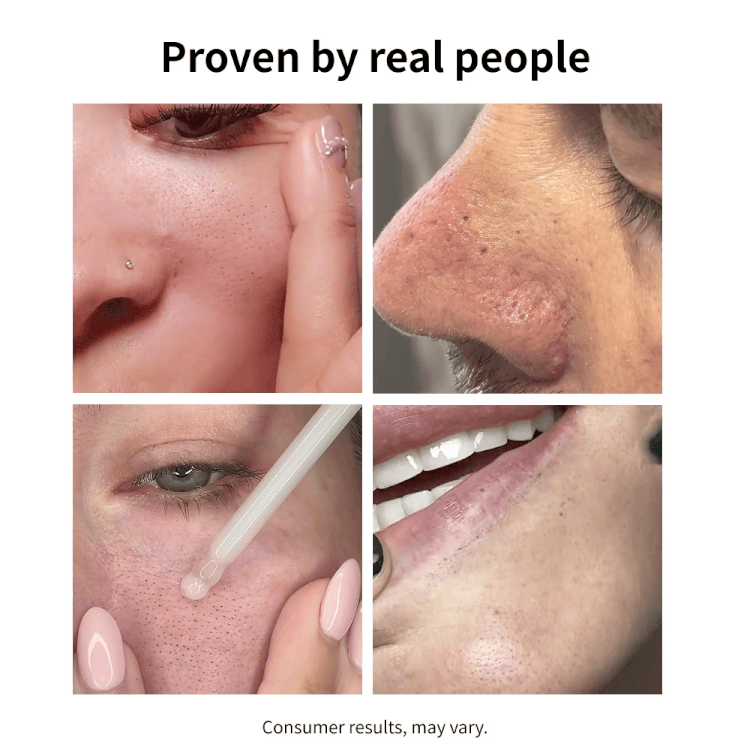 SkinShield Black Rice Blackhead Exfoliating Serum